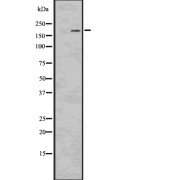Western blot analysis of LRP6 using HepG2 whole cell lysates.