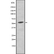 Western blot analysis of Phospho-PKM2 (Tyr105) using COLO205 whole cell lysates.