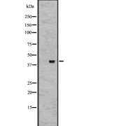 Western blot analysis of GPR27 expression in Hela cell lysate, The lane on the left is treated with the antigen-specific peptide.