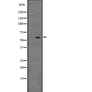 Western blot analysis of GPR75 expression in A431 whole cell lysate. The lane on the left is treated with the antigen-specific peptide.