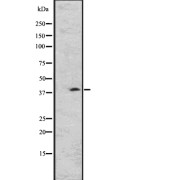 WB analysis of GPR26 expression in A431 whole cell lysate. The lane on the left is treated with the antigen-specific peptide.