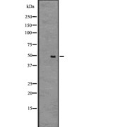 Western blot analysis of GPR61 expression in A431 cell lysate. The lane on the left is treated with the antigen-specific peptide.