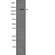 Western blot analysis of NRK expression in A549 cell line lysate. The lane on the left is treated with the antigen-specific peptide.