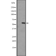 Western blot analysis of PCTK3 expression in A431 whole cell lysate. The lane on the left is treated with the antigen-specific peptide.