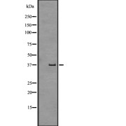 Western blot analysis of GPR43 expression in Human fetal liver lysate. The lane on the left is treated with the antigen-specific peptide.
