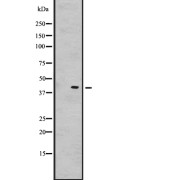 abx147576