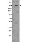 Western blot analysis of Aggrecan? using 293 whole cell lysates.