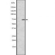 Western blot analysis of CNNM1 expression in Human tonsil tissue lysate, The lane on the left is treated with the antigen-specific peptide.