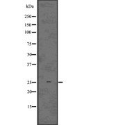 Western blot analysis of IBA1 using HeLa whole cell lysates.