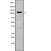 abx148170