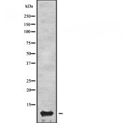 Western blot analysis of APOC3 using K562 whole cell lysates.