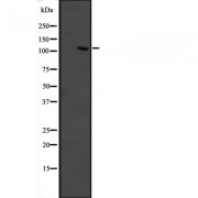 Western blot analysis of GRIP1 expression in fetal muscle lysate. The lane on the left is treated with the antigen-specific peptide.