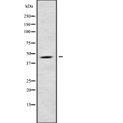 Western blot analysis of B4GALT6 using HeLa whole cell lysates.