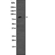 Western blot analysis of CDH12 expression in Jurkat cell lysate, The lane on the left is treated with the antigen-specific peptide.