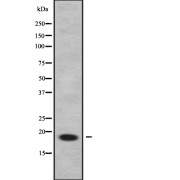 Western blot analysis of C9orf23 using LOVO whole cell lysates.