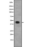 Western blot analysis of CACNG8 expression in HEK293 cells. The lane on the left is treated with the antigen-specific peptide.