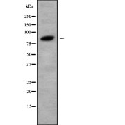 Western blot analysis of PPM1E using HuvEc whole cell lysates.
