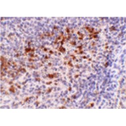 Cathelicidin Antimicrobial Peptide (CAMP) Antibody