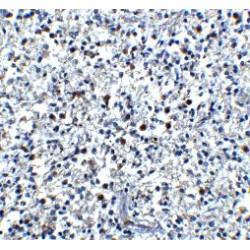 Cathelicidin Antimicrobial Peptide (CAMP) Antibody