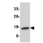 WB analysis of Human Spleen tissue, using Cathelicidin antibody (1 µg/ml).