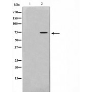 Western blot analysis of HeLa cell lysate using IL-2Rbeta/CD122 antibody, The lane on the left is treated with the antigen-specific peptide.