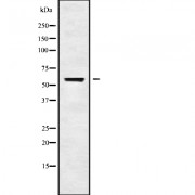 Western blot analysis of CHRNG using HT29 whole cell lysates.
