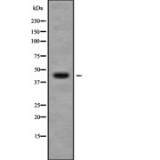 Western blot analysis of CHST11 using Jurkat whole cell lysates.