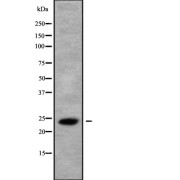 Western blot analysis of CLDN22/24 using COS7 whole cell lysates.