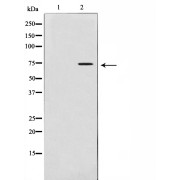 Western blot analysis of LOVO cell lysate using MMP2 Antibody.