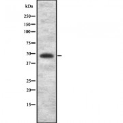 Western blot analysis of COLQ using Jurkat whole cell lysates.