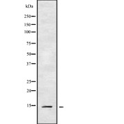 Western blot analysis of CXCL17 using HUVEC whole cell lysates.