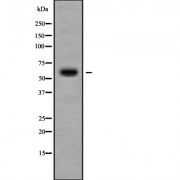 Western blot analysis of Cytochrome P450 11B2 using 293 whole cell lysates.