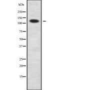 Western blot analysis of DNA2L using COLO205 whole cell lysates.