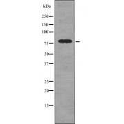 Western blot analysis of UV-treated 293 whole cell lysates, using DRP1 (pS616) antibody.