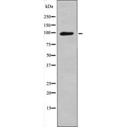 Western blot analysis of FGFR1/2 (pY730/733) using NIH-3T3 whole cell lysates.