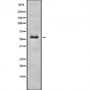 Western blot analysis of GBA using HuvEc whole cell lysates.