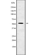 Western blot analysis of GCNT4 using HuvEc whole cell lysates.