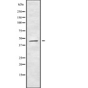 Western blot analysis of HOXB3 using K562 whole cell lysates.
