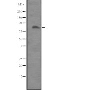 Western blot analysis of ITGB8 expression in Placenta lysate. The lane on the left is treated with the antigen-specific peptide.