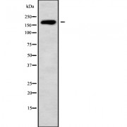 Western blot analysis of HECW1 using K562 whole cell lysates.