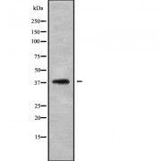 Western blot analysis of LT4R1 using HepG2 whole cell lysates.