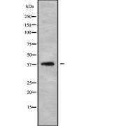 Western blot analysis of LT4R1 using HepG2 whole cell lysates.