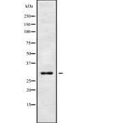 Western blot analysis of GPM6B using Jurkat whole cell lysates.