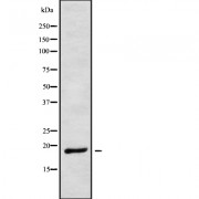 Western blot analysis of MRPL23 using K562 whole cell lysates.