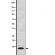 Western blot analysis of MT-ND4L using MCF7 whole cell lysates.