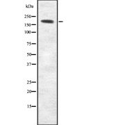 Western blot analysis of MYH2 using LOVO whole cell lysates.