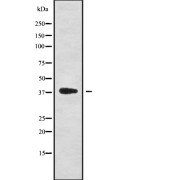 Western blot analysis of NKX61 using HepG2 whole cell lysates.