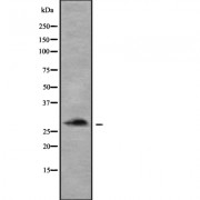 Western blot analysis of OSR1 using MCF7 whole cell lysates.