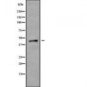 Western blot analysis of P2RX1 using K562 whole cell lysates.