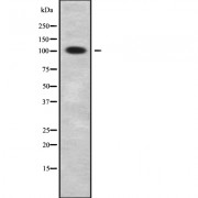 Western blot analysis of GCFC1 using Jurkat whole cell lysates.